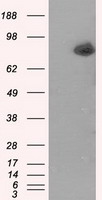 ACSBG1 antibody