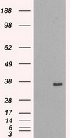 NEK6 antibody