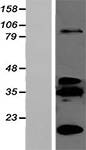 Hba-a2 Mouse Over-expression Lysate