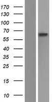 GBA Human Over-expression Lysate