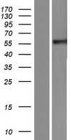 Clusterin (CLU) Human Over-expression Lysate