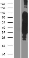 Tau (MAPT) Human Over-expression Lysate