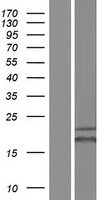 HIP2 (UBE2K) Human Over-expression Lysate