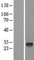 TNF alpha (TNF) Human Over-expression Lysate