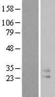 IL9 Human Over-expression Lysate