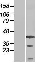 SDF1 (CXCL12) Human Over-expression Lysate