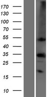 Carbonic Anhydrase IV (CA4) Human Over-expression Lysate