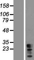 CT45A5 Human Over-expression Lysate