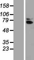 IL18R Beta (IL18RAP) Human Over-expression Lysate