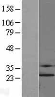 HIP2 (UBE2K) Human Over-expression Lysate