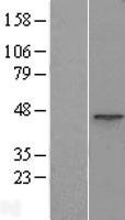 ACTR1B Human Over-expression Lysate