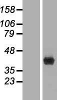FBP1 Human Over-expression Lysate