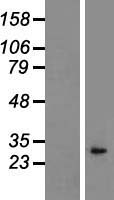 IL1 alpha (IL1A) Human Over-expression Lysate