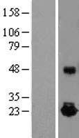 IL10 Human Over-expression Lysate
