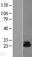 IL6 Human Over-expression Lysate