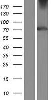 TULP4 Human Over-expression Lysate