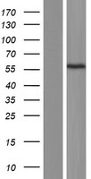 RO60 Human Over-expression Lysate