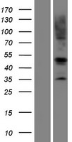 RAD51 Human Over-expression Lysate