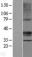 MLN64 (STARD3) Human Over-expression Lysate