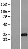 ORC6L (ORC6) Human Over-expression Lysate