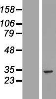 UTP11L (UTP11) Human Over-expression Lysate