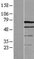 DCP1A Human Over-expression Lysate