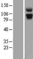 ABR Human Over-expression Lysate