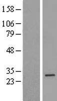RAD51 Human Over-expression Lysate