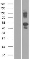 UBE2V1 (TMEM189-UBE2V1) Human Over-expression Lysate