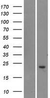 TOMM20L Human Over-expression Lysate