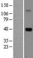 IL5RA Human Over-expression Lysate