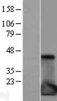 IL1RA (IL1RN) Human Over-expression Lysate