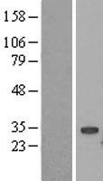 UBE2S Human Over-expression Lysate