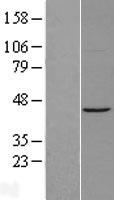 ACTR1A Human Over-expression Lysate