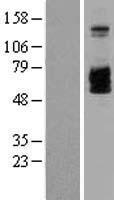 IL2 Receptor beta (IL2RB) Human Over-expression Lysate