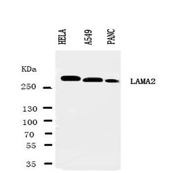 Laminin 2 alpha/LAMA2 Antibody