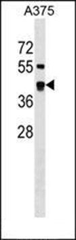 SDSL antibody