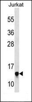 RPS23 antibody