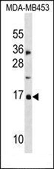 CDKN2A antibody