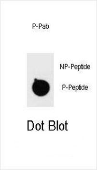 PTEN (phospho-T383) antibody