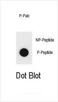 PTEN (phospho-Y315) antibody