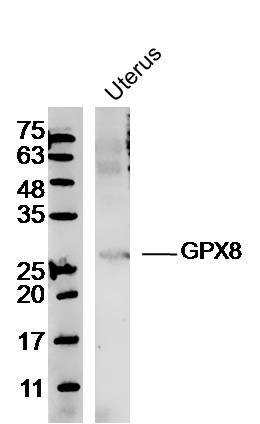 GPX8 antibody
