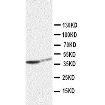 Cytokeratin 19/KRT19 Antibody