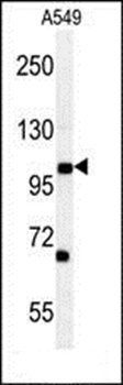 DPY19L2 antibody