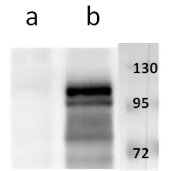 ORF11 (VZV) antibody