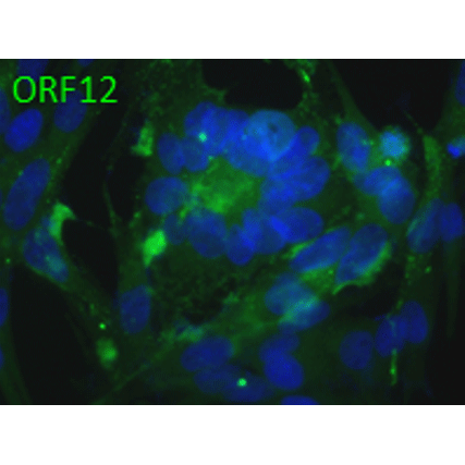 ORF12 (VZV) antibody