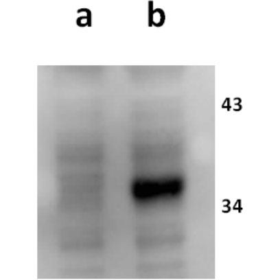 ORF18 (VZV) antibody