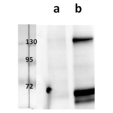 ORF31/gB (VZV) antibody