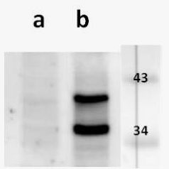 ORF33,5 (VZV) antibody