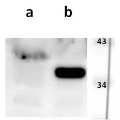 ORF41 (VZV) antibody